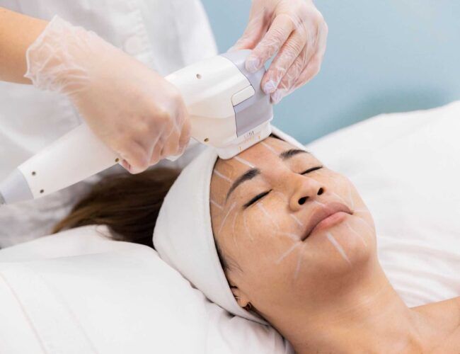 NOTOX Treatment to woman's face